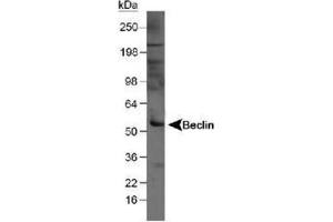 Image no. 3 for anti-Beclin 1, Autophagy Related (BECN1) antibody (ABIN363435) (Beclin 1 抗体)