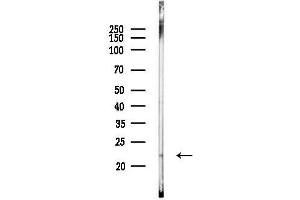 anti-Mitochondrial Ribosomal Protein L35 (MRPL35) (Internal Region) antibody