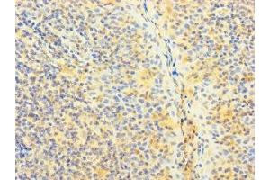 Immunohistochemistry of paraffin-embedded human tonsil tissue using ABIN7170373 at dilution of 1:100 (SNX22 抗体  (AA 1-120))