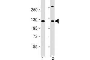 Western blot testing of human 1) A431 and 2) HeLa cell lysate with INTS6 antibody at 1:2000. (INTS6 抗体  (AA 135-167))