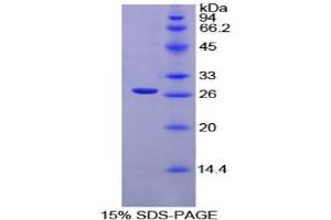 SDS-PAGE analysis of Rat XRCC6 Protein. (XRCC6 蛋白)