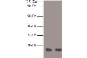 Western blot All lanes: RPA3 antibody at 2 μg/mL Lane 1: LO2 whole cell lysate Lane 2: HepG2 whole cell lysate Secondary Goat polyclonal to rabbit IgG at 1/10000 dilution Predicted band size: 14 kDa Observed band size: 14 kDa (RPA3 抗体  (AA 1-119))