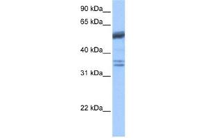 WB Suggested Anti-COIL Antibody Titration: 0. (Coilin 抗体  (C-Term))