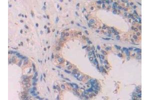 Detection of Ab1-42 in Human Prostate Tissue using Monoclonal Antibody to Amyloid Beta Peptide 1-42 (Ab1-42) (Abeta 1-42 抗体)