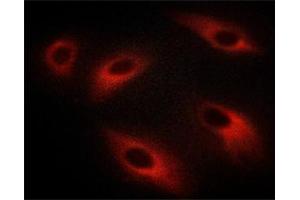 ABIN6267613 staining C6 cells treated with λ phosphatase by ICC/IF.