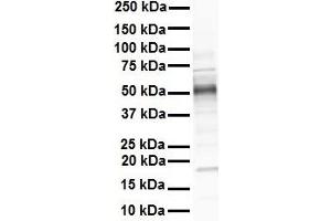 WB Suggested Anti-GREB1 antibody Titration: 1 ug/mL Sample Type: Human heart (GREB1 抗体  (N-Term))