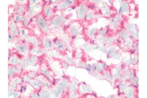 anti-Heparan Sulfate Proteoglycan 2 (HSPG2) (Domain 4) antibody