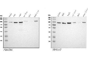 Western blot analysis of STIM1 using anti-STIM1 antibody (ABIN3043940), Left) and anti-STIM1 antibody (ABIN7606404), Right). (STIM1 抗体  (N-Term))