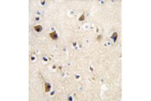 Image no. 3 for anti-Calmodulin 1 (Calm1) (C-Term) antibody (ABIN357122) (Calmodulin 1 抗体  (C-Term))
