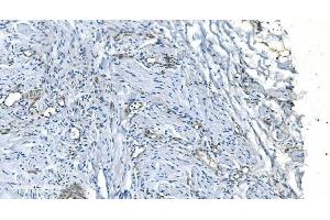 IHC analysis of GNG11 using anti-GNG11 antibody (ABIN7599533).
