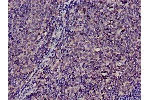 Immunohistochemistry of paraffin-embedded human lymph node tissue using ABIN7172131 at dilution of 1:100 (TMSB4X 抗体  (AA 6-44))