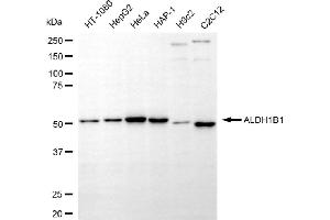 Western blotting analysis using ALDH1B1 antibody (ABIN7797559). (ALDH1B1 抗体)