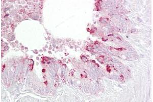 Anti-EBP1 antibody IHC staining of human lung, respiratory epithelium. (PA2G4 抗体  (AA 301-350))