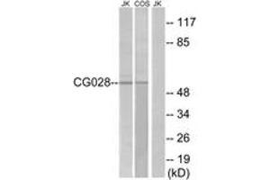 Western Blotting (WB) image for anti-CCZ1 Homolog, Vacuolar Protein Trafficking and Biogenesis Associated (CCZ1) (AA 411-460) antibody (ABIN2890813)