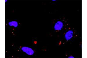 Proximity Ligation Analysis of protein-protein interactions between MAX and SMAD3. (MAX 抗体  (AA 1-151))