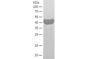 Western Blotting (WB) image for Septin 2 (SEPT2) (AA 1-361) protein (His tag) (ABIN7125024) (Septin 2 Protein (SEPT2) (AA 1-361) (His tag))