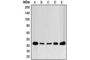 Western blot analysis of FOP expression in MCF7 (A), MDAMB231 (B), MDAMB435 (C), mouse brain (D), rat brain (E) whole cell lysates. (FGFR1OP 抗体  (C-Term))