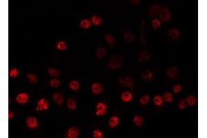 ABIN6266831 staining HeLa by IF/ICC. (ZNF225 抗体  (C-Term))