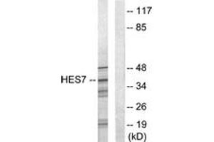 Western blot analysis of extracts from NIH-3T3 cells, using HEXIM1 Antibody. (HEXIM1 抗体  (AA 181-230))