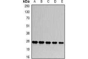 Western blot analysis of PSMA6 expression in HepG2 (A), Hela (B), mouse skeletal muscle (C), PC12 (D), COS7 (E) whole cell lysates. (PSMA6 抗体)