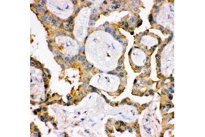 anti-Insulin Receptor Substrate 1 (IRS1) (AA 1041-1242) antibody