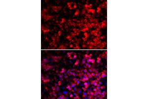 Immunofluorescence analysis of U2OS cells using QARS antibody. (QARS 抗体)