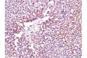 Formalin-fixed and paraffin embedded mouse stomach labeled with Anti-Calponin 1/COLP Polyclonal Antibody, Unconjugated (ABIN724820) at 1:200 followed by conjugation to the secondary antibody and DAB staining (CNN1 抗体  (AA 201-297))