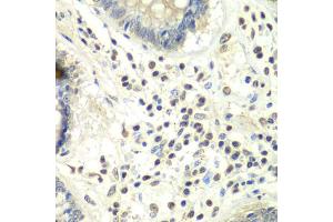 Immunohistochemistry of paraffin-embedded human colon using PRMT5 antibody. (PRMT5 抗体)