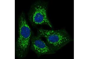 Immunofluorescence analysis of HeLa cells using TWF1 antibody (green). (TWF1 抗体  (AA 335-384))