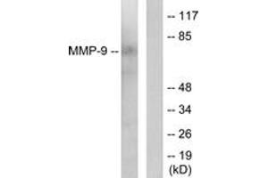 Western blot analysis of extracts from HepG2 cells, using MMP-9 Antibody. (MMP 9 抗体  (AA 651-700))