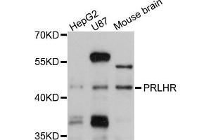 Western blot analysis of extracts of various cells, using PRLHR antibody. (PRLHR 抗体)