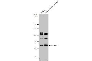 WB Image c-Myc antibody detects c-Myc protein by western blot analysis.