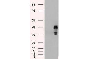 HEK293T cells were transfected with the pCMV6-ENTRY control (Left lane) or pCMV6-ENTRY SSB (Right lane) cDNA for 48 hrs and lysed. (SSB 抗体)