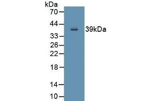 Detection of Recombinant ND5, Human using Polyclonal Antibody to NADH Dehydrogenase 5 (ND5) (MT-ND5 抗体  (AA 522-603))