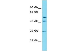 Western Blotting (WB) image for anti-Glutaredoxin, Cysteine Rich 2 (GRXCR2) (C-Term) antibody (ABIN2438093) (GRXCR2 抗体  (C-Term))