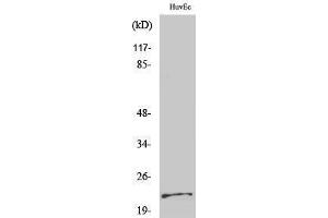 Western Blotting (WB) image for anti-Parkinson Protein 7 (PARK7) (Internal Region) antibody (ABIN3176773) (PARK7/DJ1 抗体  (Internal Region))