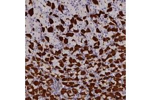 Immunohistochemical staining of human stomach with RTTN polyclonal antibody  shows strong cytoplasmic positivity in gastric parietal cells at 1:200-1:500 dilution.