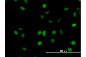 Image no. 3 for anti-Mediator Complex Subunit 21 (MED21) (AA 1-145) antibody (ABIN599079) (MED21 抗体  (AA 1-145))