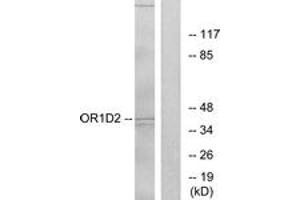 Western blot analysis of extracts from Jurkat cells, using OR1D2 Antibody. (OR1D2 抗体  (AA 201-250))