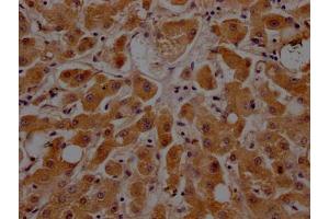 IHC image of ABIN7127343 diluted at 1:100 and staining in paraffin-embedded human liver tissue performed on a Leica BondTM system. (Recombinant APOC3 抗体)