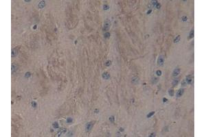 Detection of ADAMTS2 in Mouse Cerebrum Tissue using Polyclonal Antibody to A Disintegrin And Metalloproteinase With Thrombospondin 2 (ADAMTS2) (Adamts2 抗体  (AA 855-1030))