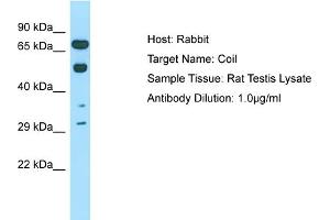 Host: Rabbit Target Name: COIL Sample Tissue: Rat Testis Antibody Dilution: 1ug/ml (Coilin 抗体  (C-Term))