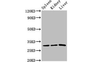 Western Blot Positive WB detected in: Rat spleen tissue, Rat kidney tissue, Rat liver tissue All lanes: CD27 antibody at 3. (CD27 抗体  (AA 20-191))