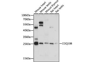 Western blot analysis of extracts of various cell lines, using COQ10B antibody (ABIN7266427) at 1:1105 dilution. (COQ10B 抗体  (AA 38-150))