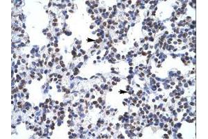 Image no. 1 for anti-Glial Cells Missing Homolog 1 (GCM1) (N-Term) antibody (ABIN6735857)