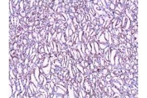 Immunohistochemical staining of formalin-fixed paraffin-embedded human kidney tissue showing nuclear and cytoplasmic staining with CLIC1 polyclonal antibody  at 1 : 100 dilution. (CLIC1 抗体  (N-Term))