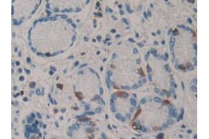 DAB staining on IHC-P; Samples: Human Stomach Tissue (PARN 抗体  (AA 178-245))