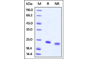 SDS-PAGE (SDS) image for Interleukin 4 (IL4) (AA 25-153) (Active) protein (His tag,AVI tag,Biotin) (ABIN3137668)