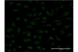 Immunofluorescence (IF) image for anti-C-Myc Binding Protein (MYCBP) (AA 34-103) antibody (ABIN525697)