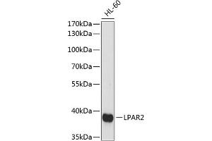 Western blot analysis of extracts of HL-60 cells, using LP antibody (ABIN7268335) at 1:1000 dilution. (EDG4 抗体  (AA 250-350))
